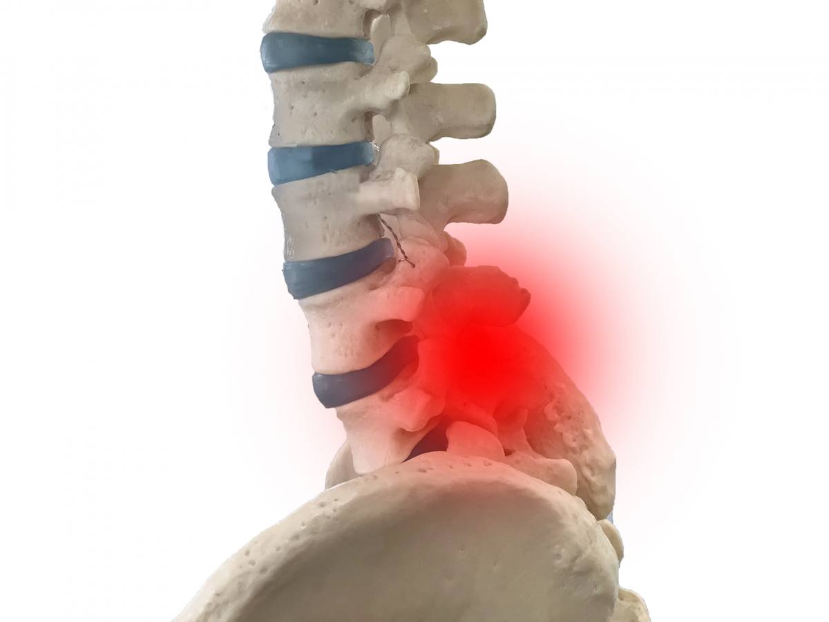 腰椎の立体模型で、下部の一か所が赤く光り痛む場所を示している